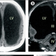 Escáner del cerebro del paciente. The Lancet